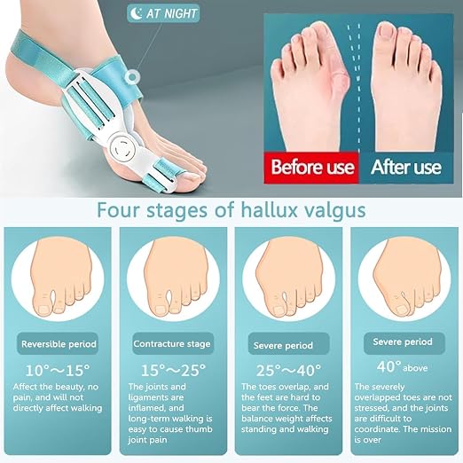 Orthopedic Big Toe Support for Pain Relief Pack Of 1
